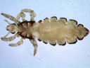 Head Louse - Tx Dept State Health Services