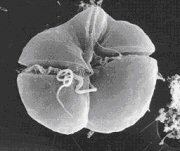 image of red tide dinoflagellate 