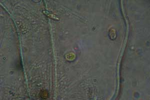 golden alga cells