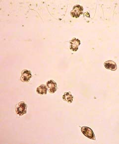 Karenia brevis cells in water sample