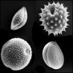 Microscopic pollen magnified many times; photo courtesy of LaTrob University
